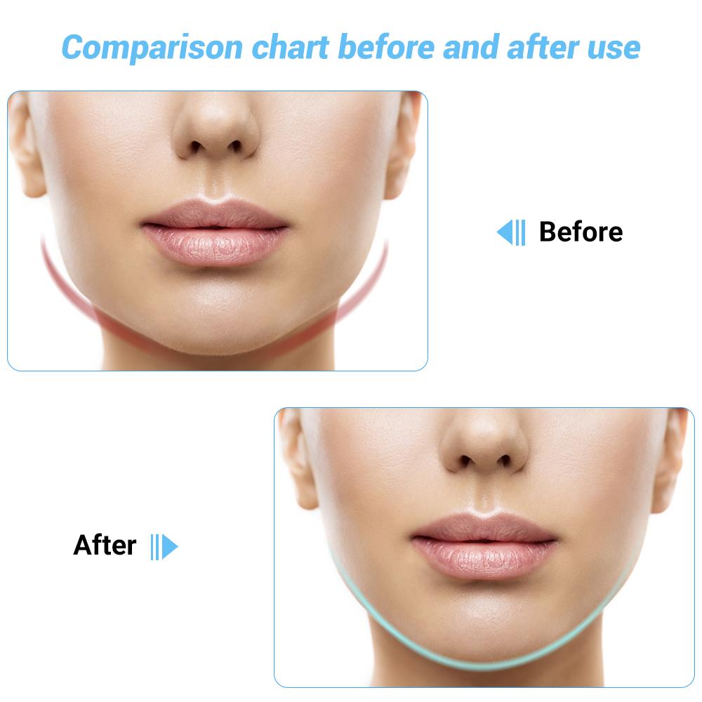 SculptGlow™ Face Lifter – EMS, Light Therapy & Heat Tightening