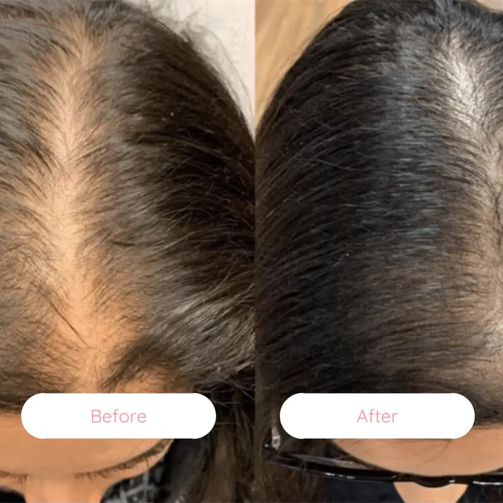 HairRestore Pro™ Laser Brush – Regrow Hair & Reverse Hair Loss Naturally