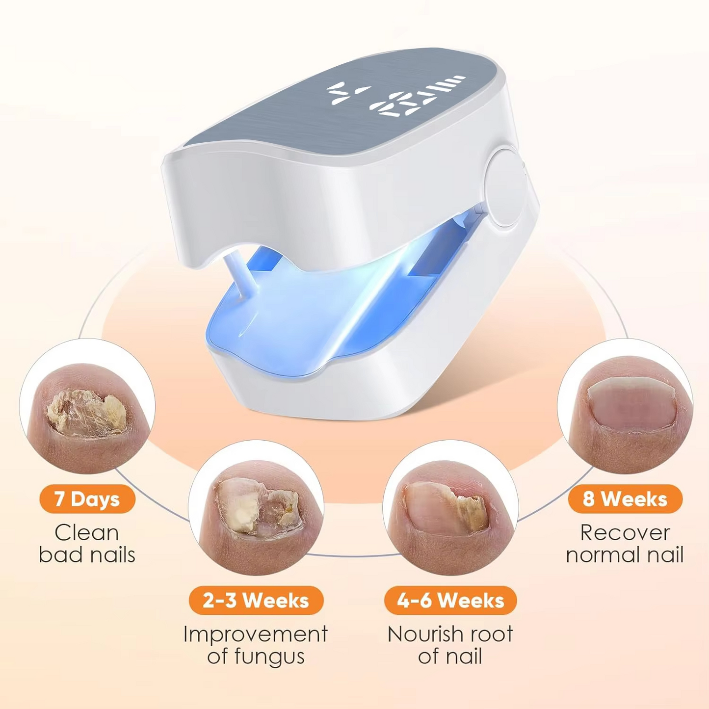 NailRestore™ Laser – 7-Min Daily Fungus Treatment, FDA-Cleared