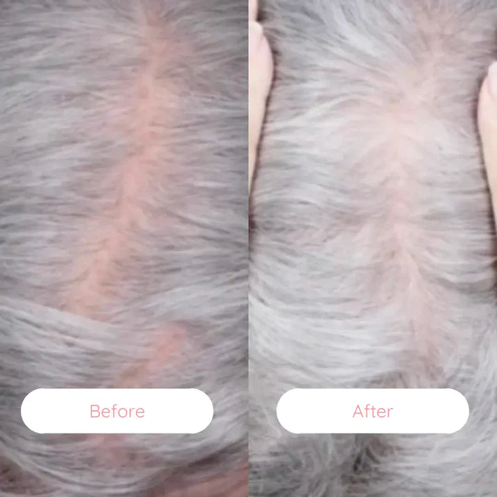 HairRestore Pro™ Laser Brush – Regrow Hair & Reverse Hair Loss Naturally