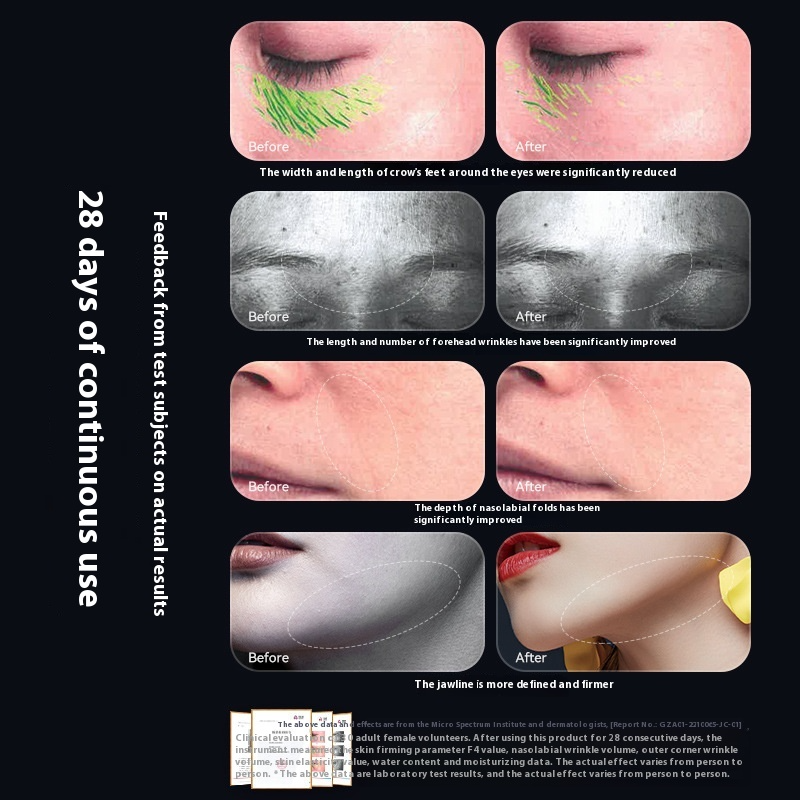 RadianceLift™ Neck Device – 5-in-1 Tightening with Morpheus-Level Results