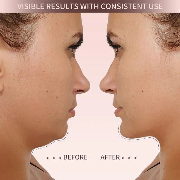 Eleve™ Lift & Sculpt Face Shaper – Effortless Jawline Definition, Day or Night