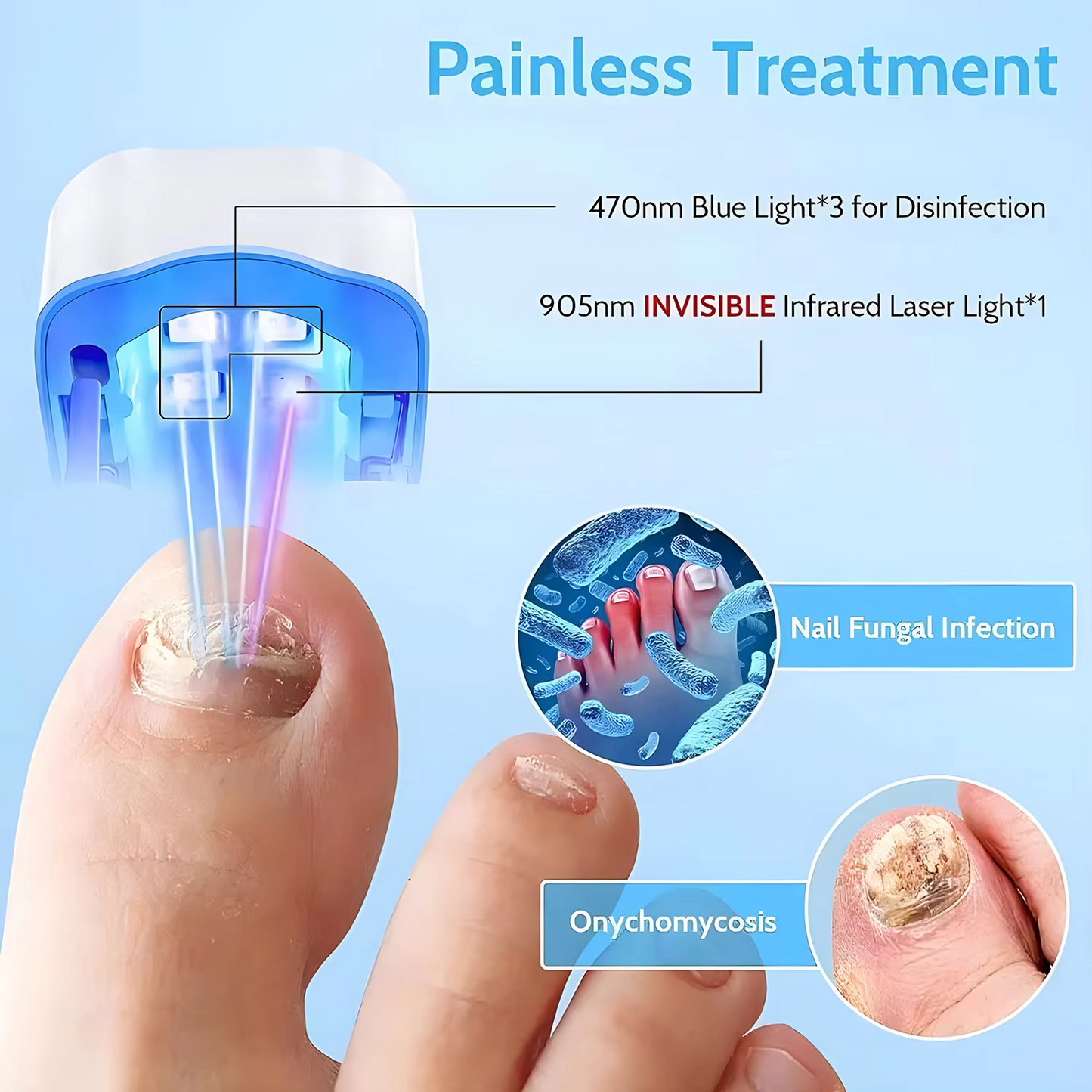 NailRestore™ Laser – 7-Min Daily Fungus Treatment, FDA-Cleared
