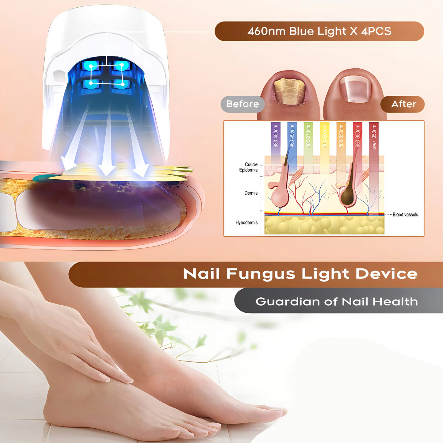 NailRestore™ Laser – 7-Min Daily Fungus Treatment, FDA-Cleared