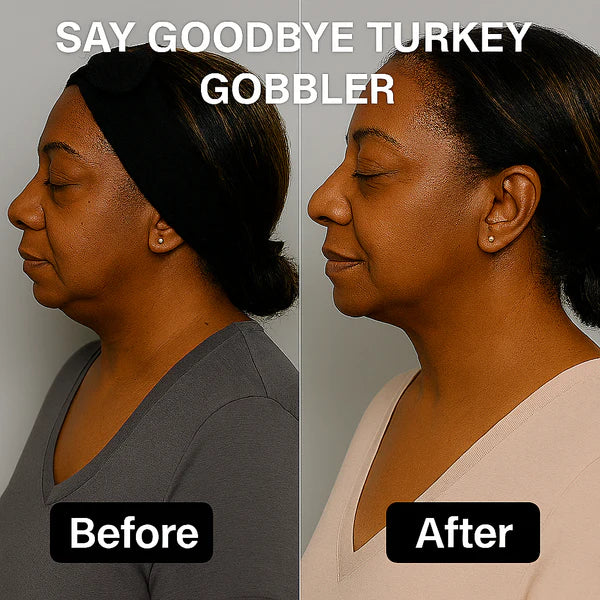Eleve™ Lift & Sculpt Face Shaper – Effortless Jawline Definition, Day or Night