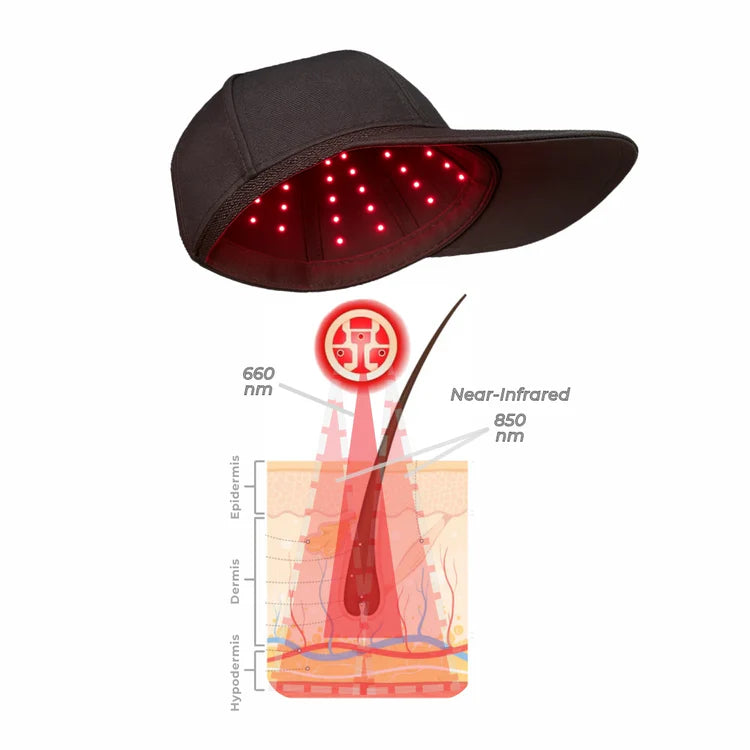 HairRegen™ LED Cap – Boost Hair Growth & Scalp Health