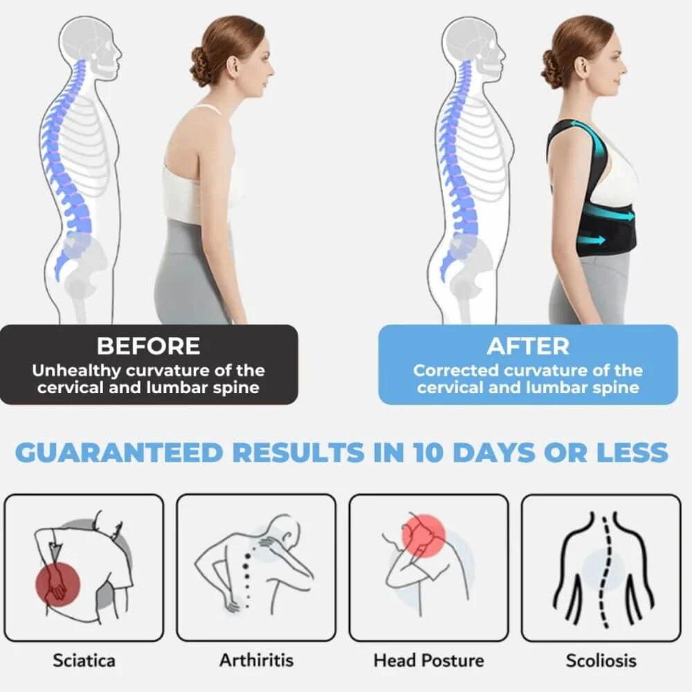 PosturePro™ Adjustable Posture Corrector