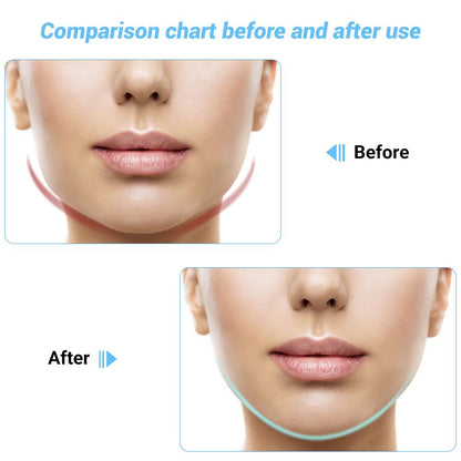 SculptGlow™ Face Lifter – EMS, Light Therapy & Heat Tightening