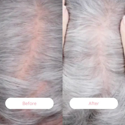 HairRestore Pro™ Laser Brush – Regrow Hair & Reverse Hair Loss Naturally