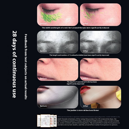 RadianceLift™ Neck Device – 5-in-1 Tightening with Morpheus-Level Results