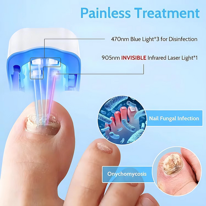 NailRestore™ Laser – 7-Min Daily Fungus Treatment, FDA-Cleared