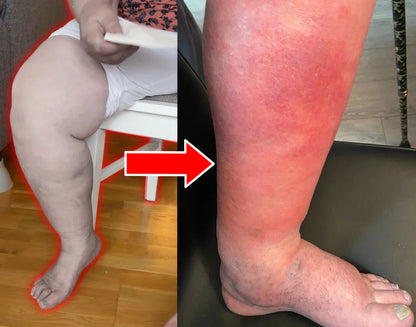 TheraFlex™ Leg Massager – Heat, Compression & Swelling Relief
